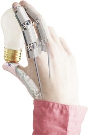 Prosthetic arm