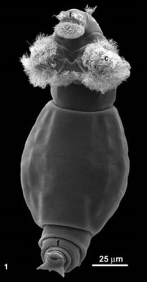 a rotifer