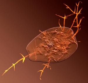 Rotifer, infected with fungus