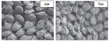 EM images of gut lumen, for two mice: one with and one without the bacteria